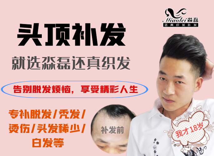 青海织发 青海织发