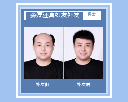 广东青海织发教您正确保养头发