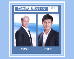 泸州青海织发补发男士织发价格