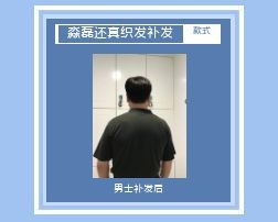 抚顺西宁假发解决男士需求